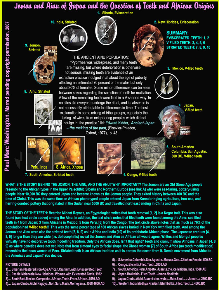  THE ANCIENT AINU POPULATION:
            �Pyorrhea was widespread, and many teeth 
        are missing, but where deterioration is otherwise
      not serious, missing teeth are evidence of an 
extraction practice induldged in at about the age of puberty, 
affecting an estimated 70 percent of the males but only 
about 30% of females. Some minor differences can be seen 
between sexes regarding the selection of teeth for mutilation. 
A few of the remaining teeth were filed in a V-shaped way. In 
no sites did everyone undergo the ritual, and its absence is 
not necessarily attributable to differences in time. The best
 explanation is some mixing of tribal groups, especially the 
   taking  of wives from neighboring peoples which did not 
    indulge in  the practice.� IN: Edward Kidder,  Ancient Japan 
        � the making of the past, (Elsevier-Phiadon, 
                            Oxford, 1977),  p. 43.WHAT IS THE STORY BEHIND THE JOMON, THE AINU, AND THE ANU? WHY IMPORTANT? The Jomon are an Old Stone Age people
resembling the African types in the Upper Paleolithic Siberia snf Northern Europe (see link A) who were sea-faring, pottery-using
people. Near 10,000 BC they entered Japan and became known as the Jomon people. They exited history between 400 BC and the
time of Christ. This was the same time an African-phentyped people entered Japan from Korea bringing agriculture, iron-use, and
herring-combed pottery that originated in the Sudan near 5500 BC and travelled northeast ending in China and Japan. 

THE STORY OF THE TEETH: Beatrice Midant Reynes, an Egyptologist, writes that tooth removal [1, 2] is a Negro trait. This was also
found (see text circle above) among the Ainu). In addition, the text circle notes that filed teeth were found among the Ainu (see filed
teeth in 4 from Japan; 3 from Africans in Mexico; 5, 6 from the Congo. The text circle above notes that as much as 70% of the population
had V-filed teeth!!  This was the same percentage of 180 African slaves buried in New York with filed teeth. And among the Jomon and 
Ainu were also the striated teeth [8, 9] as in Africa and India of its prehistoric African phase. The Japanese cranium [4, 8, 9] longer than 
they are wide (i.e. doliocephalic) reveal the Jomon and Ainu as African all would agree. Whites and Mongul peoples virtually have no
decorative tooth modelling tradition. Only the African does. Isn�t that right? Teeth and cranium show Africans in Japan as where 
genetics does not yet. Genes aren�t god and cannot prove everything. Archeology can suffice where genetics do not touch African history...art, art history, Paul Marc Washington, paleoneolithic@yahoo.com 